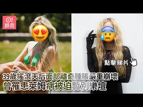 前性感艷星現身曾志偉齋宴　濾鏡過重變詭異臉早年曾意外毁容｜01娛樂｜香港名人｜香港明星｜香港藝人